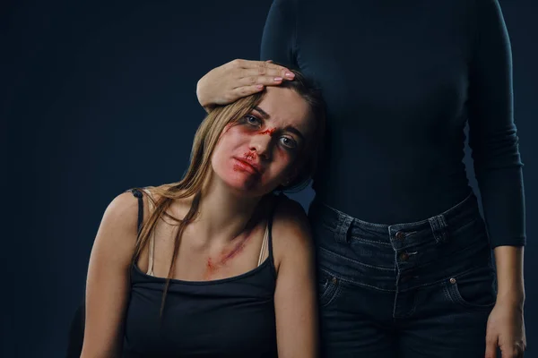 Female in black blouse has put her hand on head of a girl. Victim with bruises on face sitting nearby. Blue background. Domestic violence. Close-up. — 스톡 사진