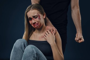 Strong man put his hand on female shoulder. Scared victim with bruises on face sitting nearby. Blue background. Domestic violence, abuse. Close-up.