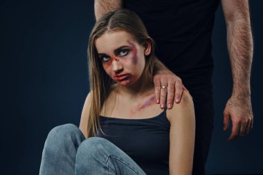 Strong man put his hand on female shoulder. Scared victim with bruises on face sitting nearby. Blue background. Domestic violence, abuse. Close-up.