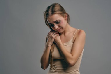 Yüzünde çürükler olan sarışın kız, ellerini göğsüne bastırmış, gri stüdyo arka planında poz vermiş. Aile içi şiddet, taciz. Yakın plan, kopyalama alanı.