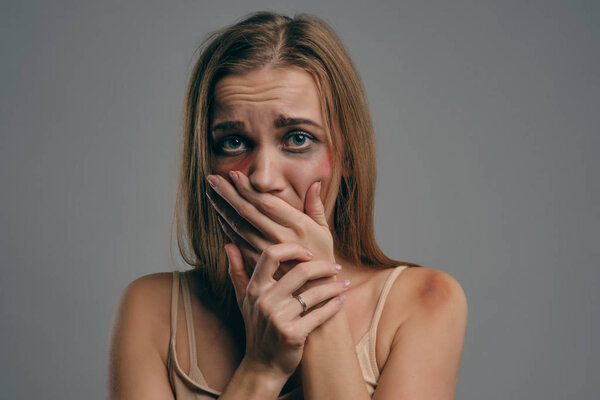Blonde girl with bruises is covering her face, posing on gray studio background. Domestic violence, abuse. Close-up, copy space.