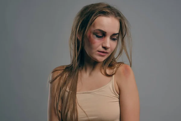 ブロンドの女の子と顔にあざがグレーのスタジオの背景にポーズをとっています。家庭内暴力虐待。うつ病絶望。閉鎖、コピースペース. — ストック写真