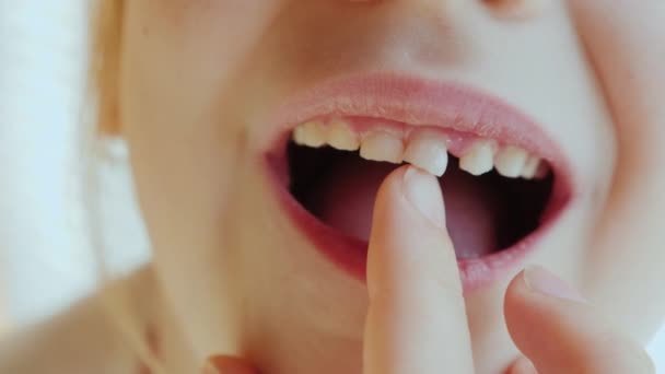 Der Zahn der Babys ist bereit, auszufallen — Stockvideo