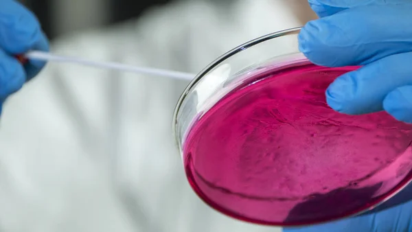 Laboratório faz pesquisa microbiológica com um prato tigela — Fotografia de Stock