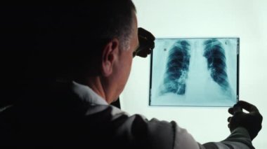 Doktor akciğerlerin röntgenini inceliyor.