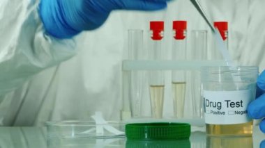 Laboratuvar teknisyeni uyuşturucu ve doping için idrar testleri yapıyor. Spor hekimi