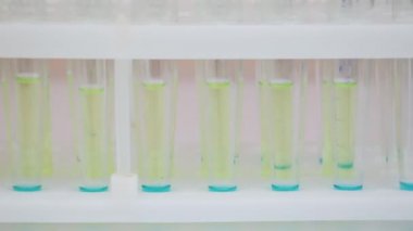 Hastalık araştırması için mavi solüsyonla dolu cam tüpler yakından gösteriliyor. Kamera sağdan sola doğru sorunsuzca hareket eder. Dikkatini dağıtıyor. Nazik beyaz ışık.