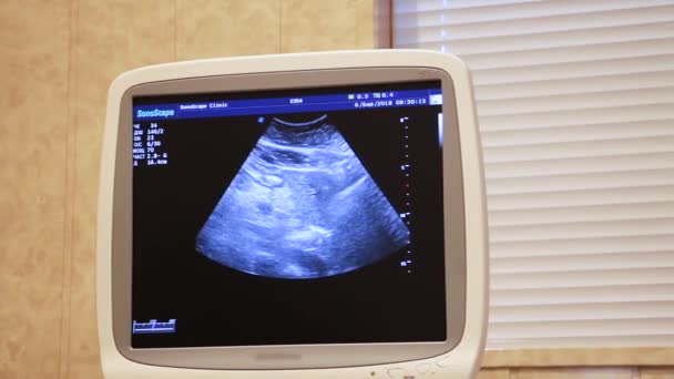 Zobrazen Monitor Funkčního Moderního Ultrazvuku Kterém Provádí Lékařská Studie Hladký — Stock video
