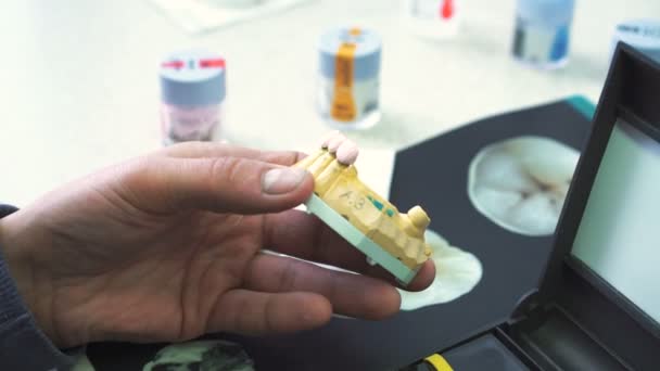 Il dentista fa il modello della mascella umana in 4K — Video Stock