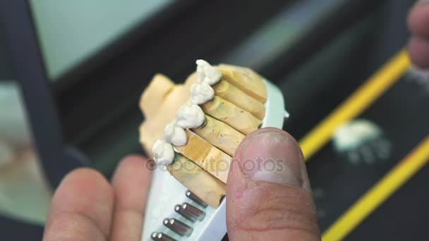 Tandtechnicus keramiek glazuur toe te passen op een afgietsel gemaakt met tandheelkundige Cnc-machine — Stockvideo