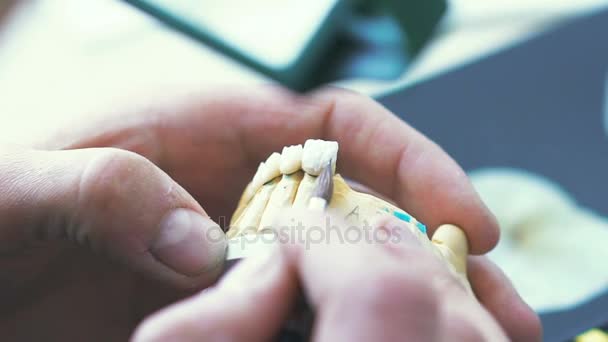 Diş teknisyeni Cnc diş makine ile yapılmış bir döküm seramik sır uygulamak — Stok video