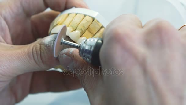 Close-up van tanden-kronen slijpen met instrumenten in dental lab — Stockvideo