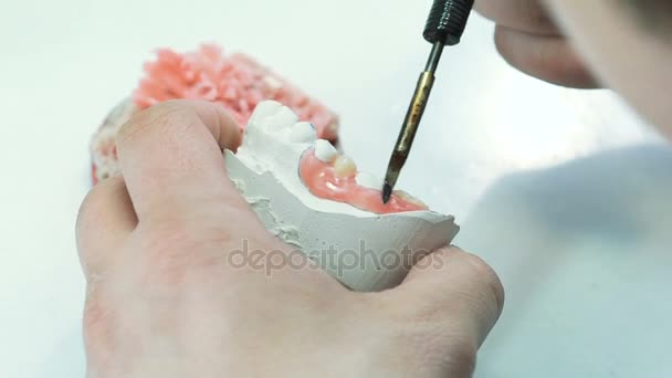 Close-up de fazer prótese humana com cera dental — Vídeo de Stock