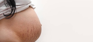 Hamile karında gerilme izleri, cilt bakımı konsepti, panoramik model.