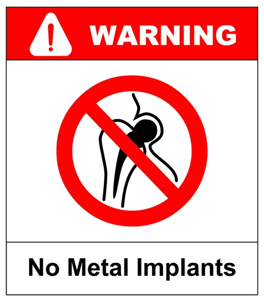 금속 기사 또는 시계 없이, 금속을 가진 사람에 대 한 액세스할 수 없습니다 표시 임 플 란 트 — 스톡 벡터