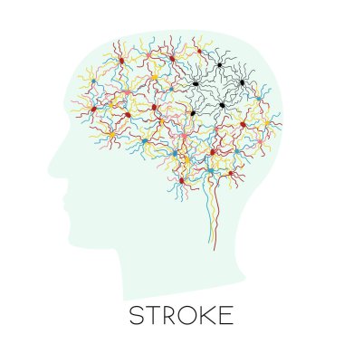 Stroke concept with human head silhouette clipart