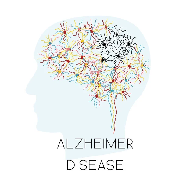 Conceito de doença de Alzheimer —  Vetores de Stock