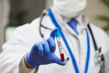 Koruyucu yüz maskesi takmış bir bulaşıcı hastalık doktoru elinde koronavirüs kan tüpü testi gösteriyor. COVID-19 kan örneğinin yakın plan fotoğrafı..