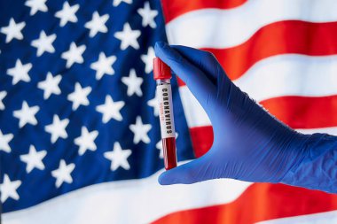 Amerika Birleşik Devletleri bayrağına karşı pozitif koronavirüs kan testi yapan bir doktorun eli..