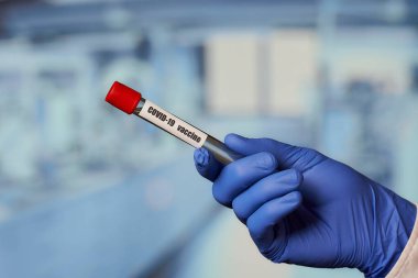 Laboratuvarda mavi tek kullanımlık tıbbi eldivenli bir laboratuvar asistanının Coronavirus 'a karşı bir aşı ile test tüpü tutması (COVID-19)..
