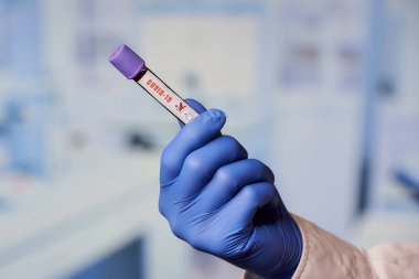 Laboratuvarda pozitif koronavirüs (COVID-19) kan testi yapan tek kullanımlık mavi eldivenli bir laboratuvar asistanının eli..