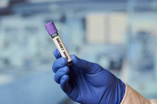 Egy Fertőző Betegségekkel Foglalkozó Orvos Keze Kék Egyszer Használatos Orvosi — Stock Fotó