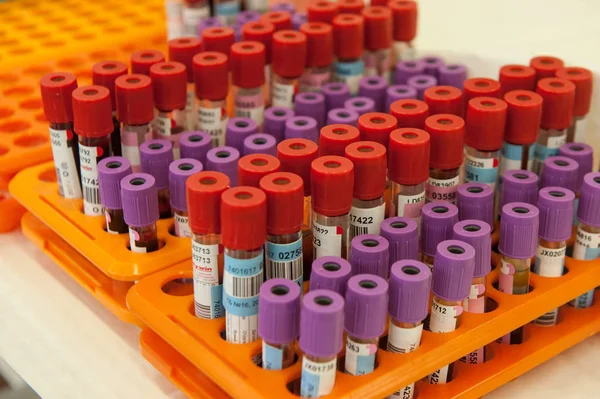 Kan örnekleri test tüpleri bir kan nakli istasyonu