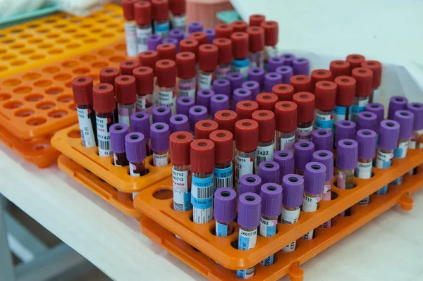 Kan örnekleri test tüpleri bir kan nakli istasyonu