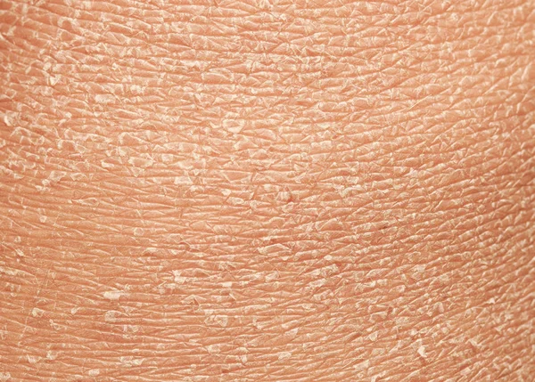 gros plan de lhomme de peau macro epidermis photo thinkstock photos de ichtyose images de ichtyose depositphotos 174 gros plan de lhomme de peau macro epidermis photo thinkstock photos de ichtyose images de ichtyose depositphotos 174