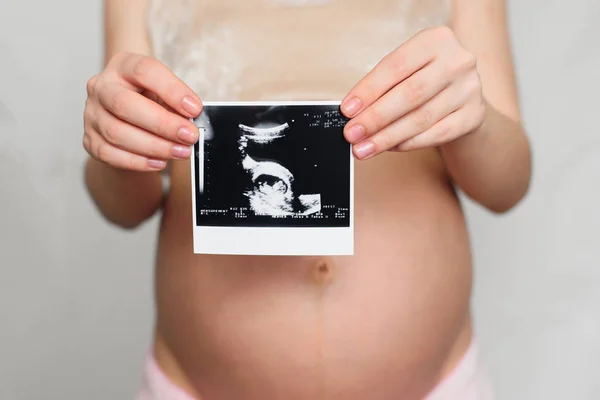 Photo d'une échographie enceinte dans les mains d'une fille enceinte — Photo