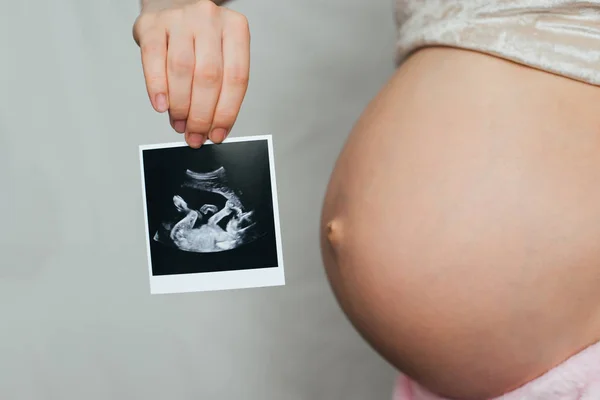 Image échographie dans les mains d'une fille enceinte — Photo
