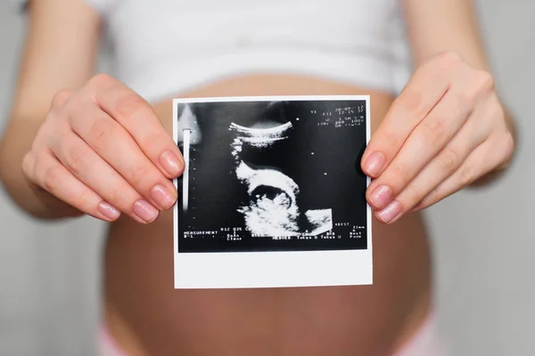 Foto eines schwangeren Ultraschalls in den Händen eines schwangeren Mädchens — Stockfoto