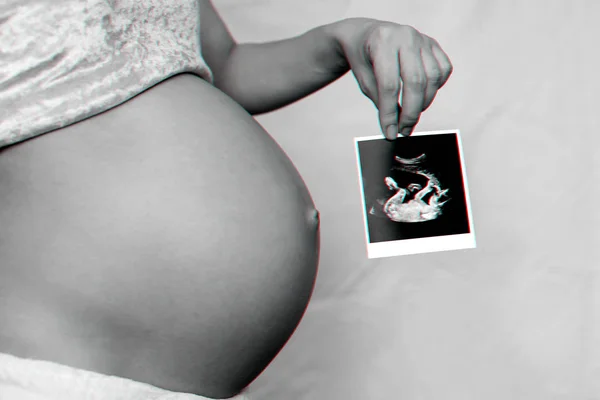 Photo d'une échographie enceinte dans les mains d'une fille enceinte — Photo