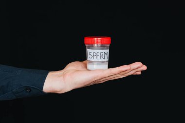 test için bir erkek donör elinde sperm kavanoz