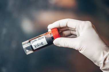 Doctor, laborant holding ampoule of blood with potential koronavirus infection