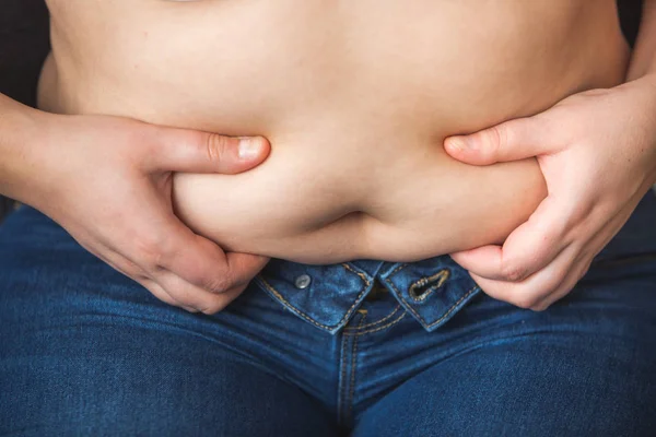 Mulher mostrando barriga gorda, gordura no abdômen, conceito de saúde — Fotografia de Stock