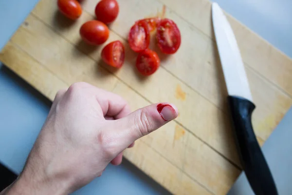 Young man finger cut while cooking a lunch, bleeding, cooking injury — Stock Photo, Image
