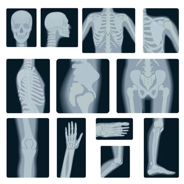 Aşırı kalite gerçekçi vektör kolaj birçok röntgen çekim ayarlayın. Yetişkin insanların birden fazla bölümünü x-ışını. — Stok Vektör