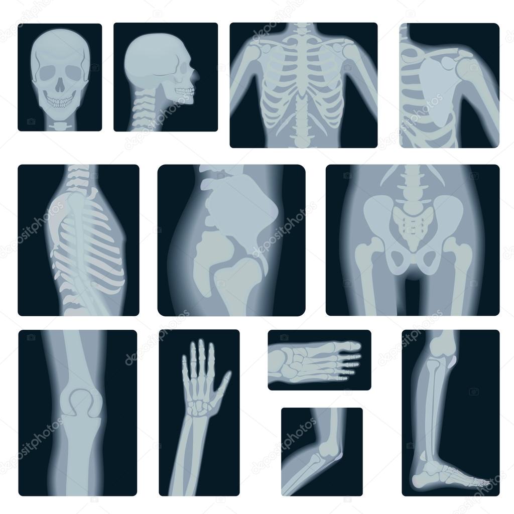 Extreme quality realistic vector collage set of many X-rays shots. X-ray multiple part of adult people.