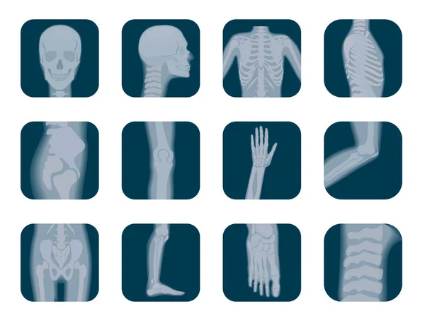 Vector realistiska röntgen skelett ikoner set. Människans skelett xray element. Kroppen delar ikonen. — Stock vektor