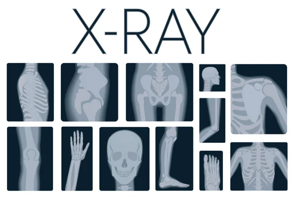 Extreme quality realistic vector collage set of many X-rays shots. X-ray multiple part of adult people. — Stock Vector