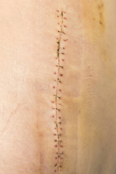 рана на коже
