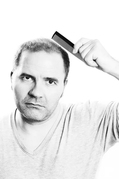 Middle-aged man concerned by hair loss Baldness alopecia Black and white — Stock Photo, Image