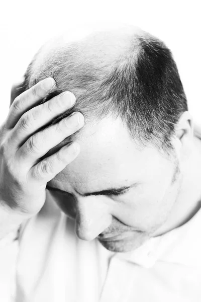 Man van middelbare leeftijd verontrust over haarverlies kaalheid alopecia zwart-wit — Stockfoto