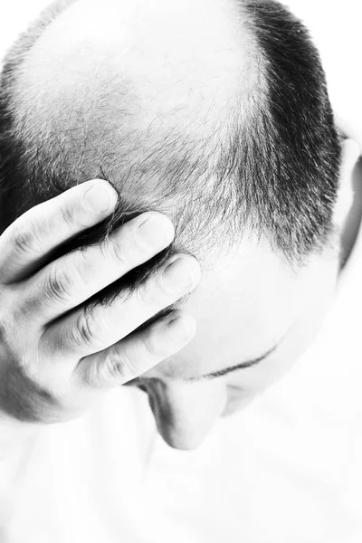 Man van middelbare leeftijd verontrust over haarverlies kaalheid alopecia zwart-wit — Stockfoto