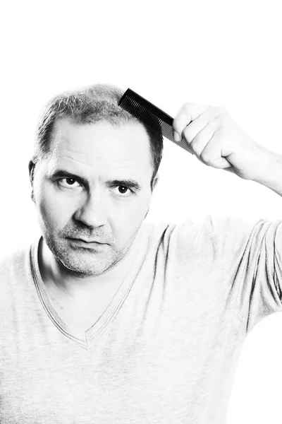 Homem de meia-idade preocupado com a perda de cabelo Calvície alopecia isolado — Fotografia de Stock