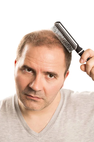 Mann mittleren Alters besorgt über Haarausfall Haarausfall Alopezie isoliert — Stockfoto