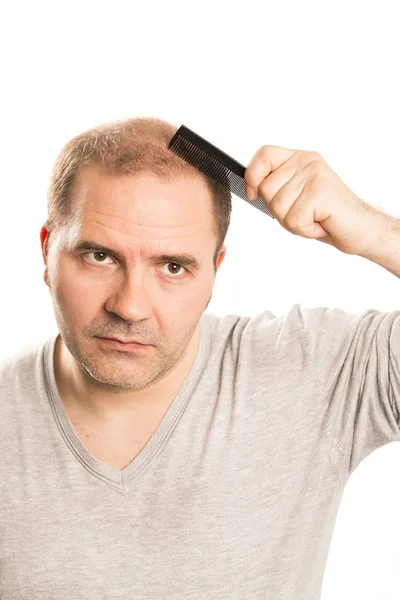 Homem de meia-idade preocupado com a perda de cabelo Calvície alopecia isolado — Fotografia de Stock
