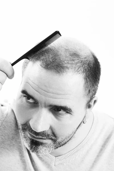 Homem de meia-idade preocupado com a perda de cabelo Calvície alopecia close up preto e branco, fundo branco — Fotografia de Stock
