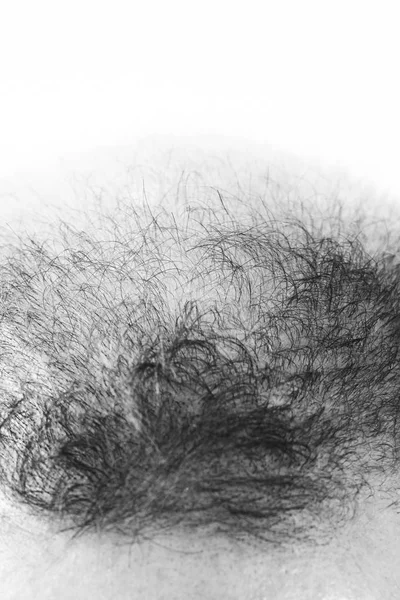 Hombre de mediana edad preocupado por la pérdida de cabello alopecia calvicie primer plano blanco y negro, fondo blanco —  Fotos de Stock